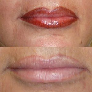 maquillage permanent lèvres
